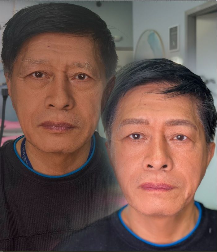 Nanoblanding for men 02