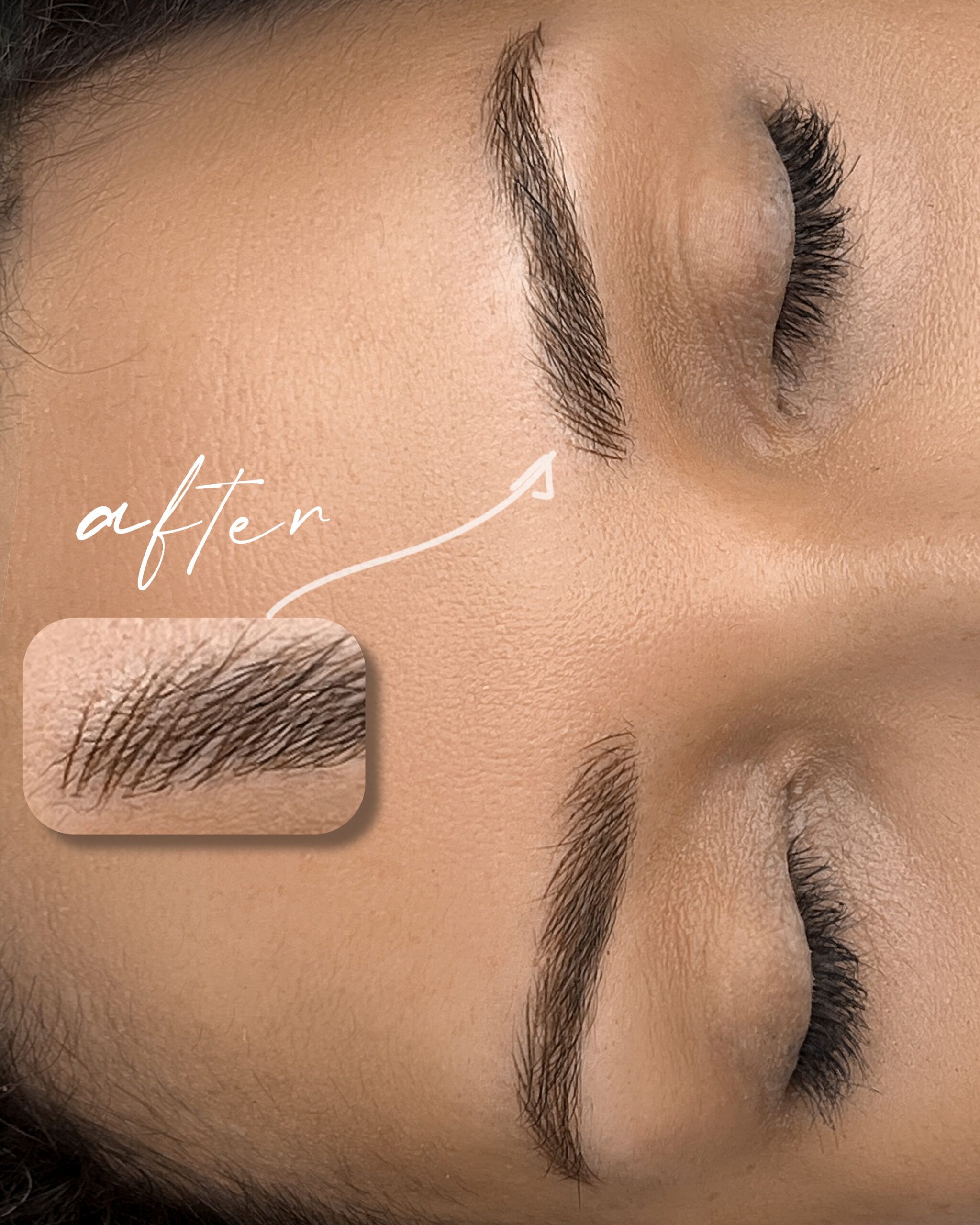 Nano Eyebrows Before and After