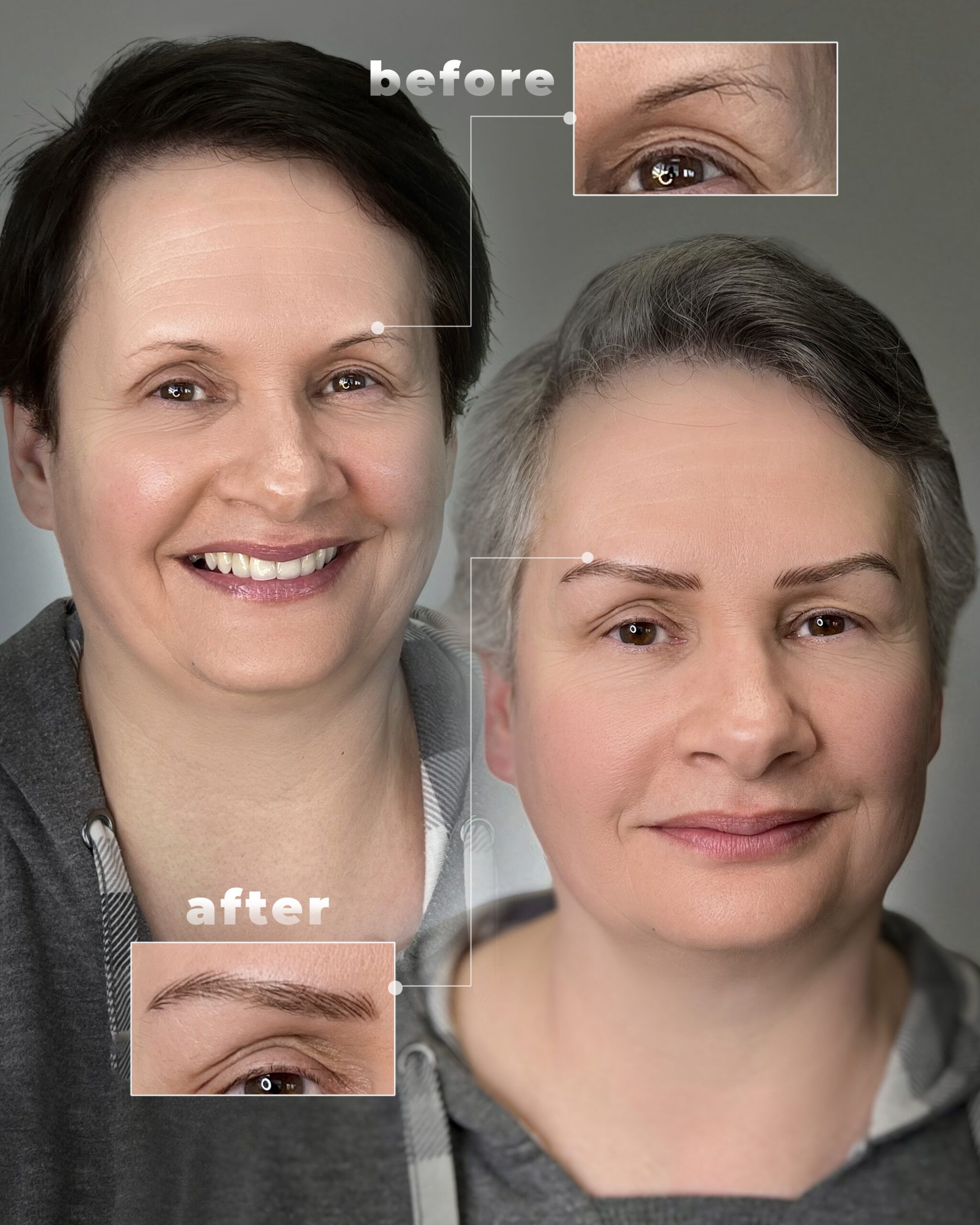 Nano Eyebrows Before and After