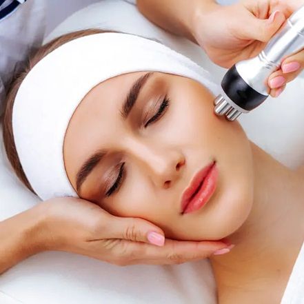 Radiofrequency (RF) Lifting