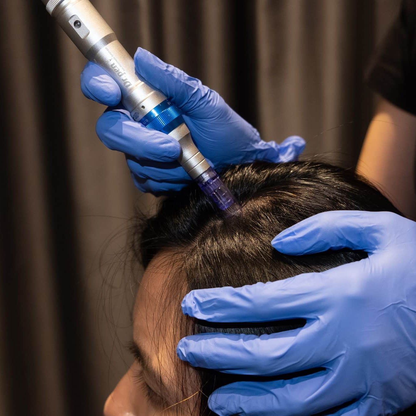 hair mesotherapy