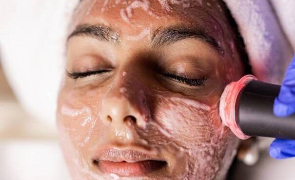 oxygeneo facial edmonton