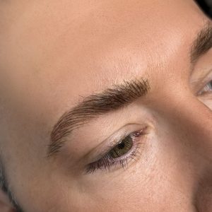men brow restoration after nano side
